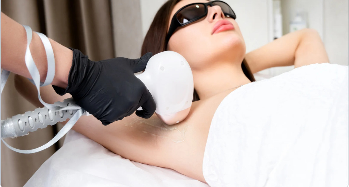 Épilation laser à Ludres – réduction progressive de la pilosité